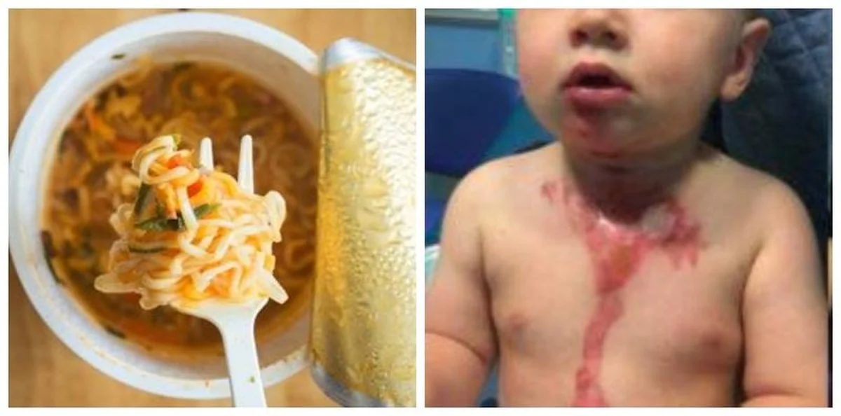 Proč zkušení kardiologové nikdy nepovažují instantní polévky za rychlý oběd - image 1