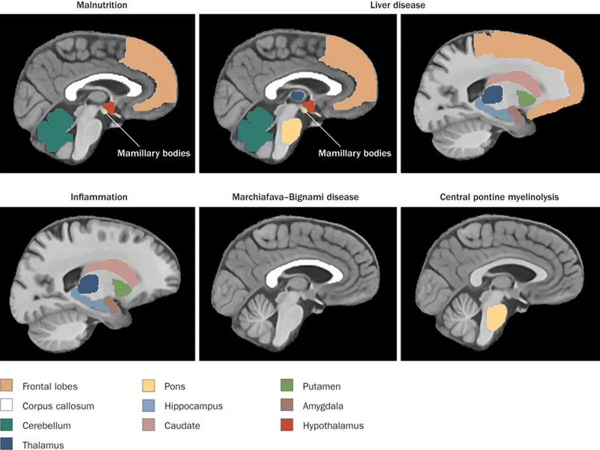 kazdasklenkasko-extra-2.webp Každá sklenka škodí: Proč už věda nezná bezpečnou hranici alkoholu - image 2