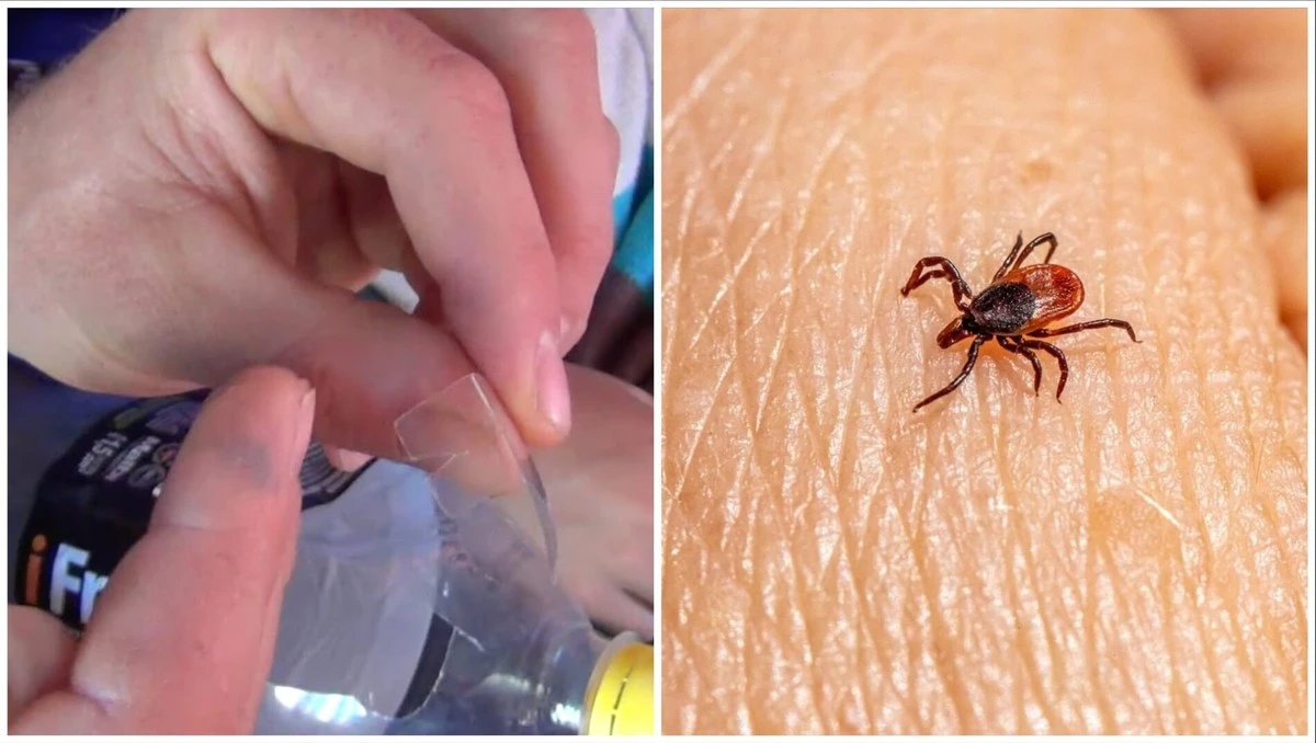 Jak vyndat klíště rychle a bezpečně: lesníci používají tuto jednoduchou metodu s PET lahví