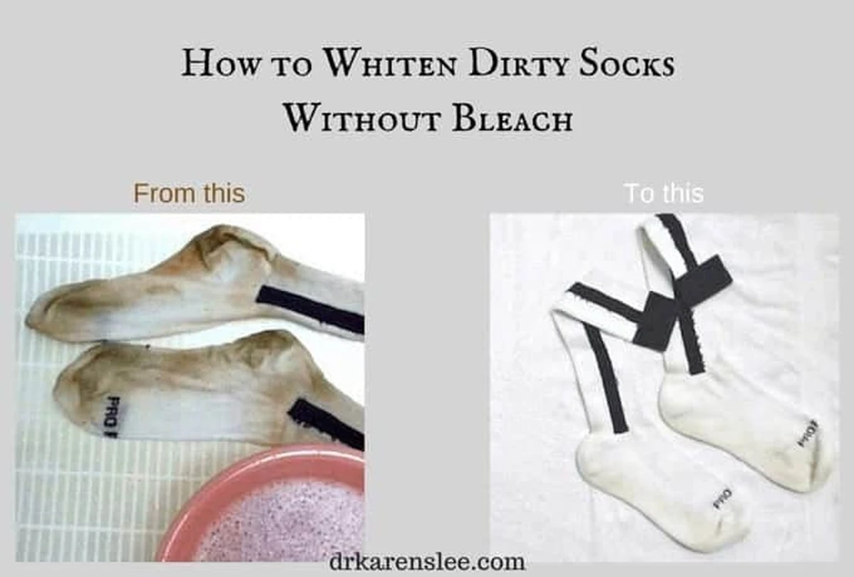 Proč vaše ponožky po minutě vypadají jako nové: trik s čističem koberců - image 1