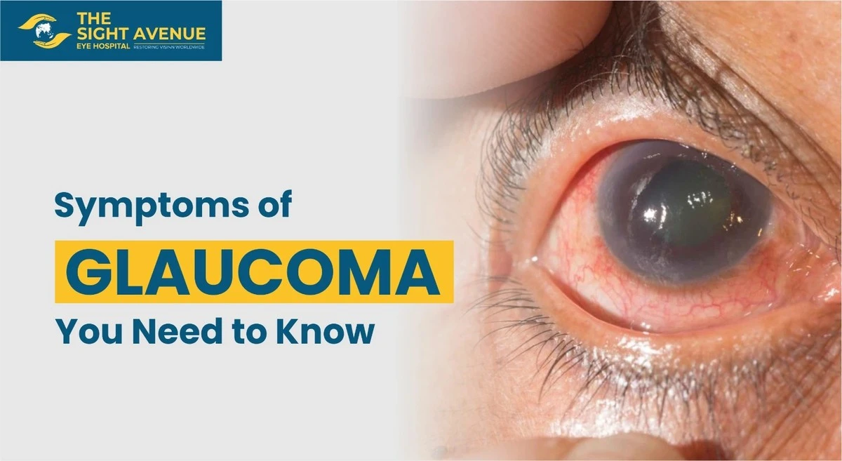 Zelený zákal: polovina lidí neví, že ohrožuje jejich zrak - image 1