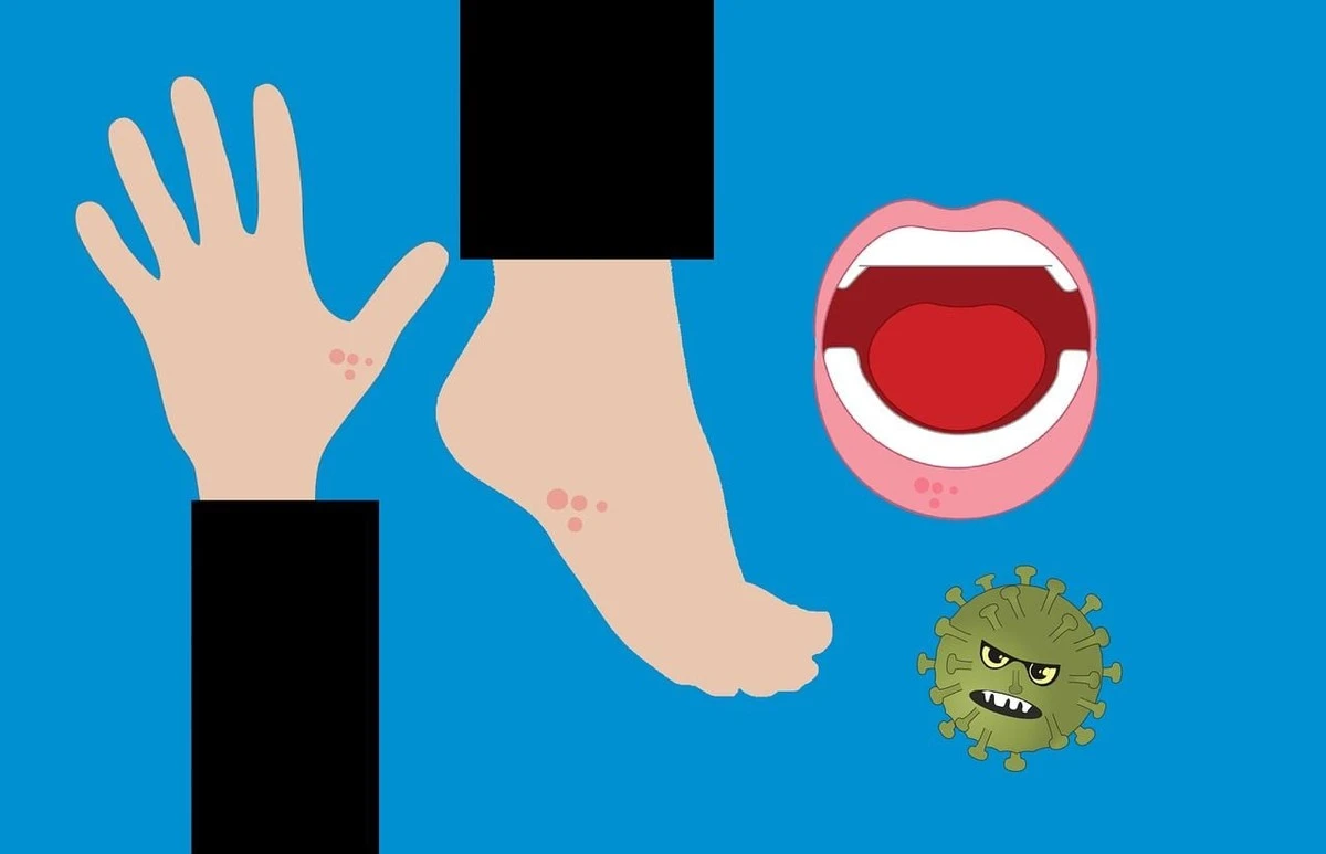 Nečekané řešení: Proč se zbavit svědění a zarudnutí způsobeného kvasinkami zvládnete sami