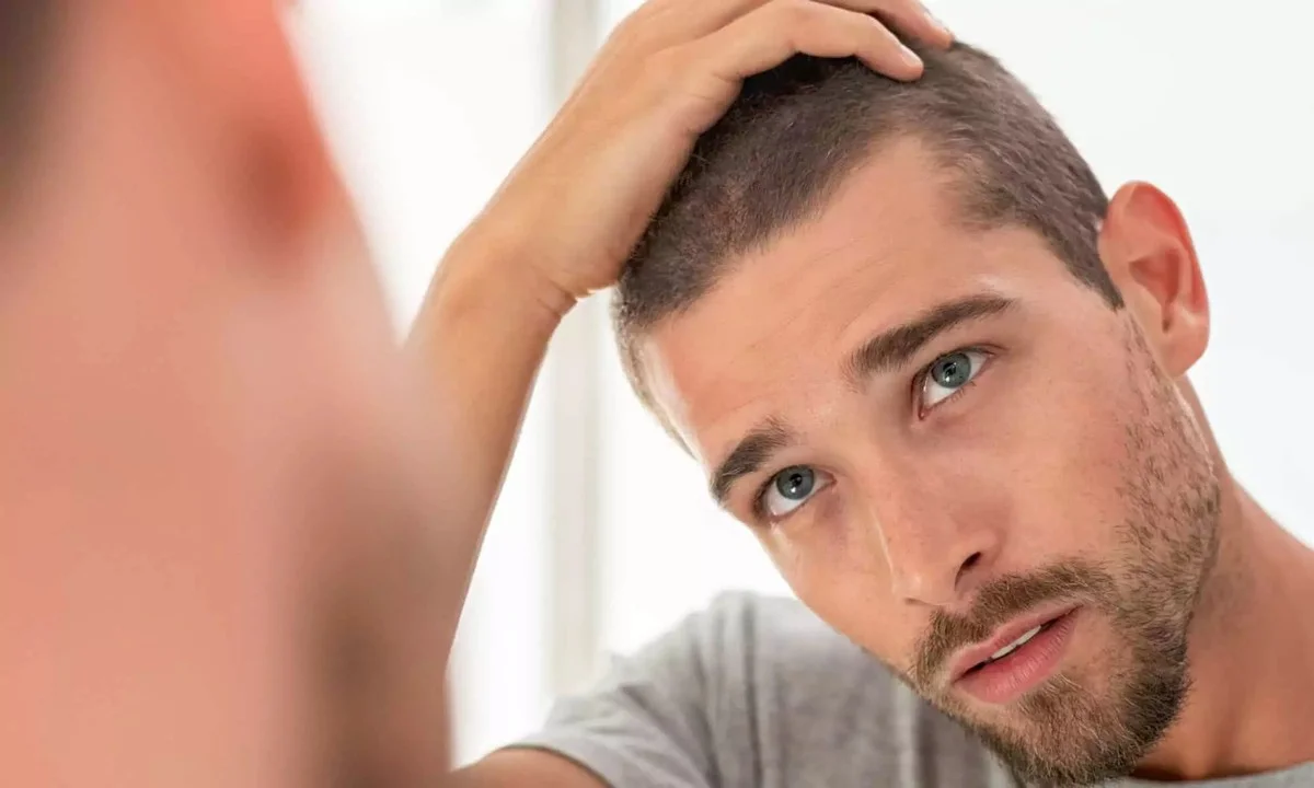 Tři měsíce padají vlasy: Zjistěte, kdy už stres nestačí a musíte k dermatologovi - image 2