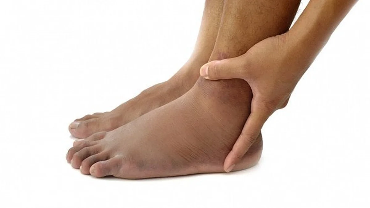 Proč zkušení lékaři zkoumají kotníky, když mají podezření na vysoký cholesterol - image 2