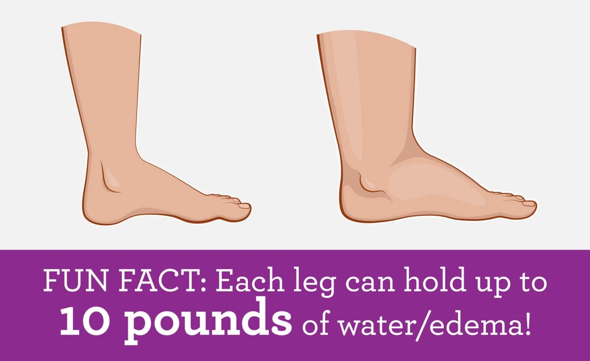 zapomentenatezk-extra-1.webp Zapomeňte na těžké nohy: 3 cviky, které vám uleví od křečových žil - image 1