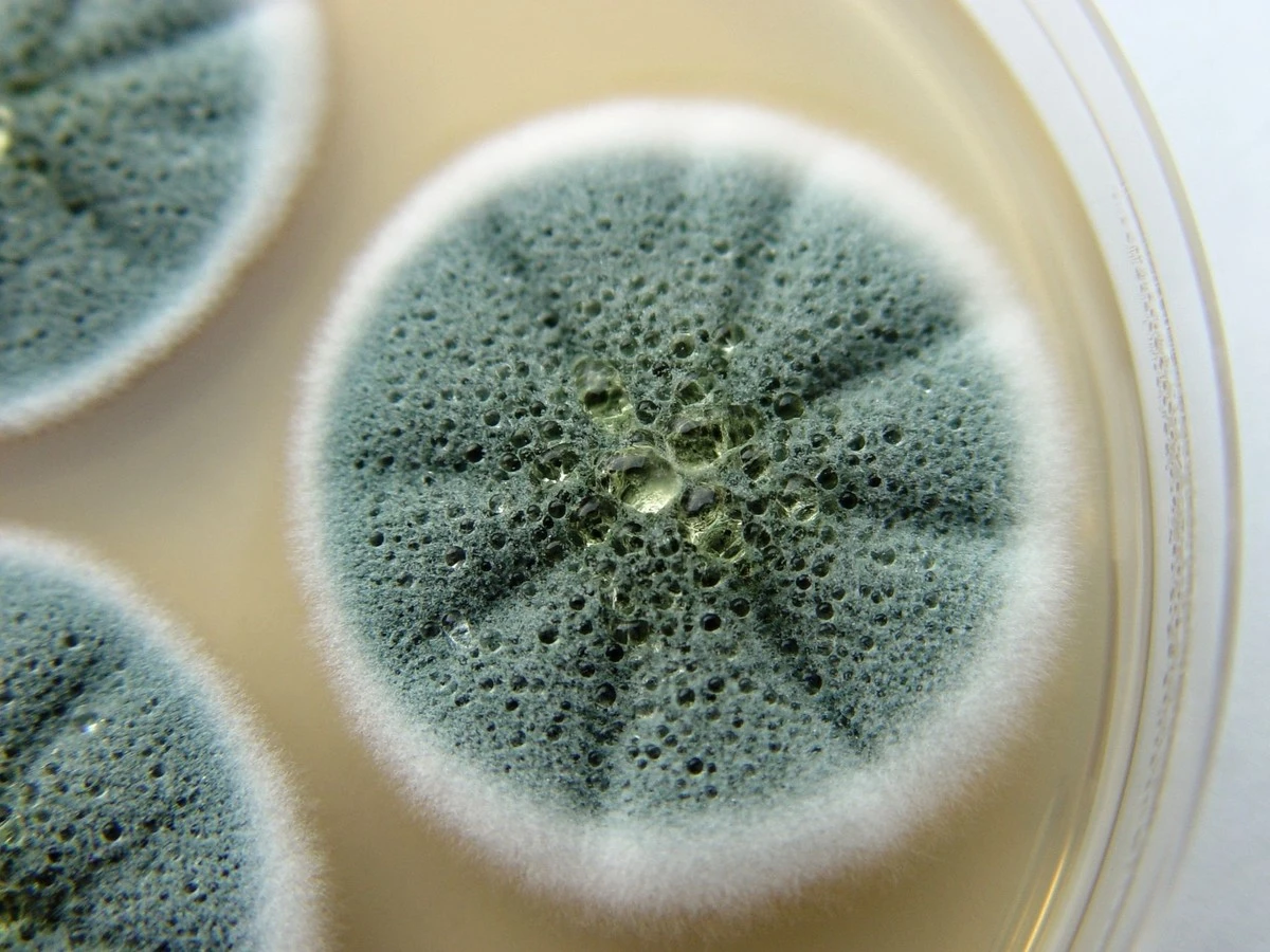 Domácí prostředek na plísně: Směs jedlé sody a octa zatočí s černými fleky po celé domácnosti - image 1